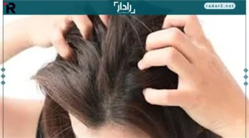 حكة شديدة.. تعرف على أبرز الأسباب الطبية وعلاج فروة الرأس الفعّال